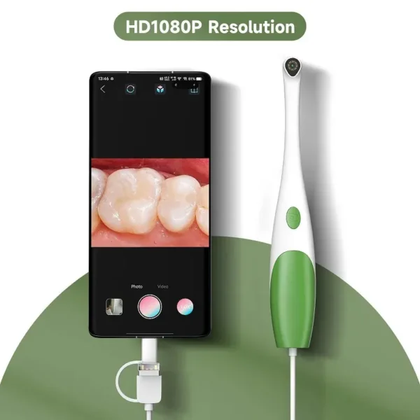 hd 1080p video prikaz intraoralna kamera detaljan pregled