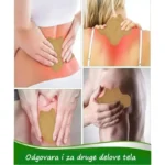 Flasteri za kolena
