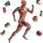 Kinesio trake
